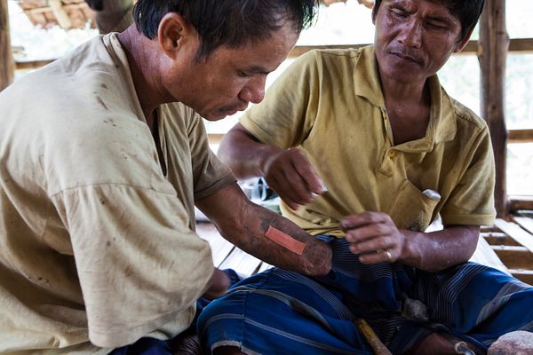 The Landmine Victims of Myanmar’s Civil War – The Diplomat