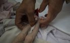 Emaciated Children in Kabul Hospital Underscore Rising Hunger in Afghanistan